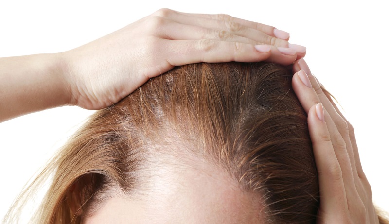 The secret for a healthier scalp! – Say Adios to hair loss shampoo!