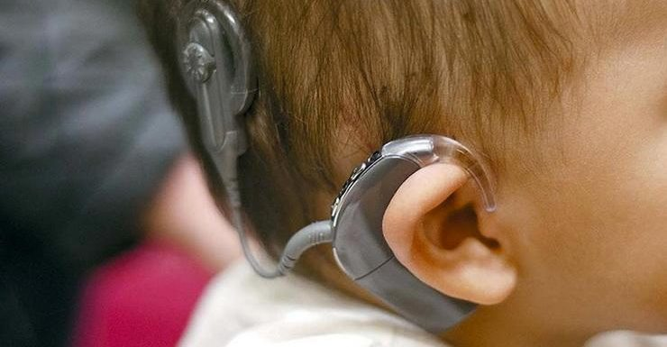 Implantable Hearing Devices