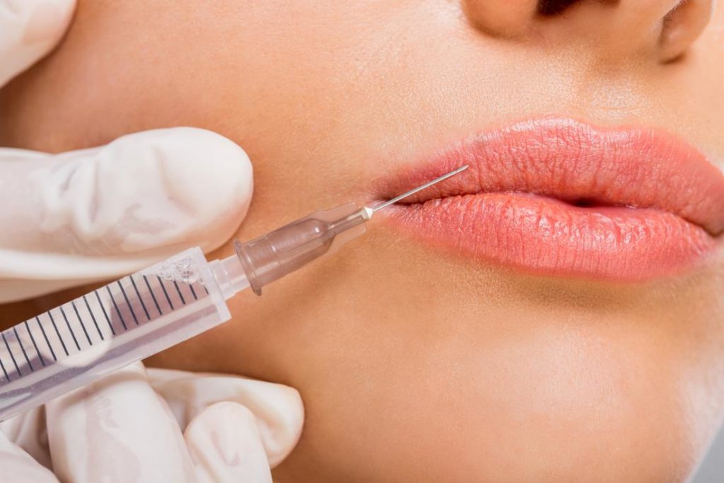 How Lip Fillers Work – A Quick Post! 