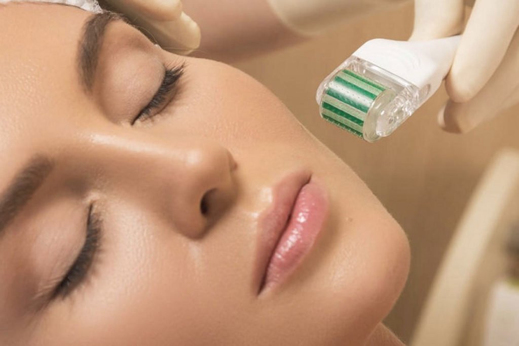 What You Should Know About PRP Therapy & Microneedling