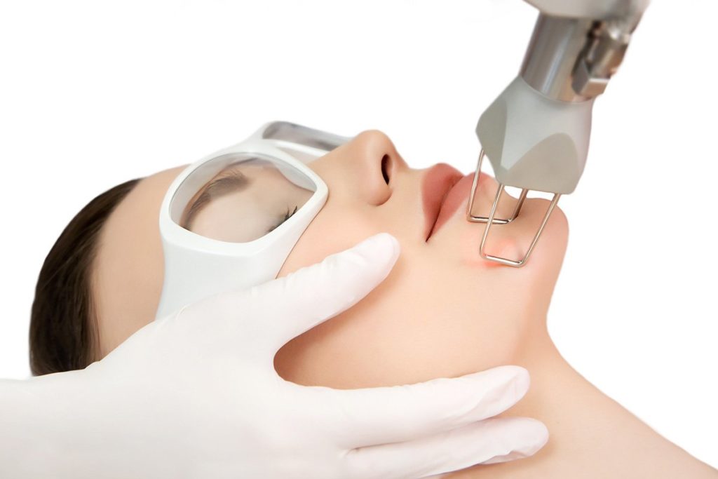 How Fractional Laser Resurfacing Restores your Youthful Appearance
