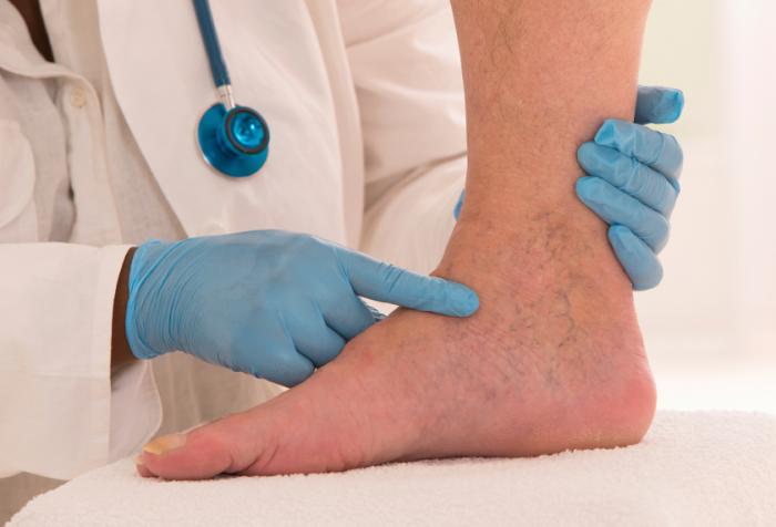 Diagnosis and treatment of lymphedema in Tamarac