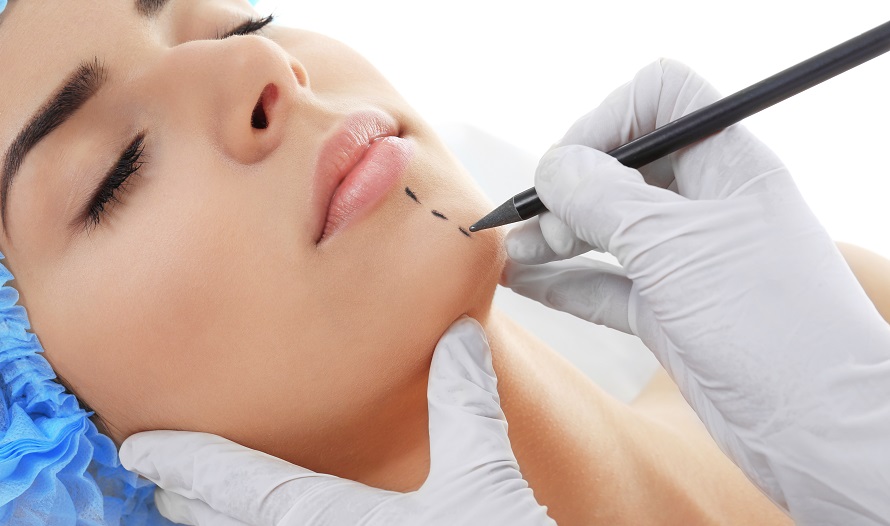 Exceptional Chin Augmentation In New York And Connecticut