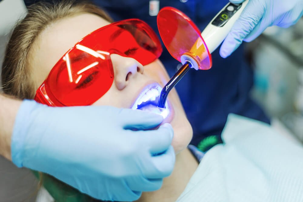 7 Benefits of Laser Dentistry You Should Know
