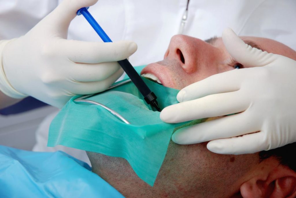 How to Establish When You Need a Root Canal?