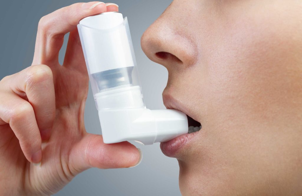 An Ultimate Guide to Asthma Management