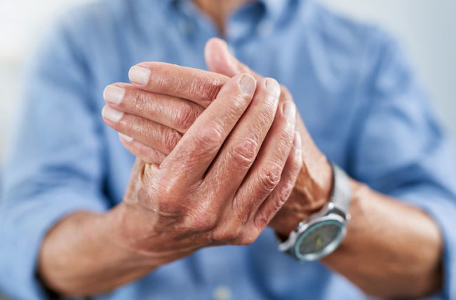 When To See A Doctor For Arthritis Pain