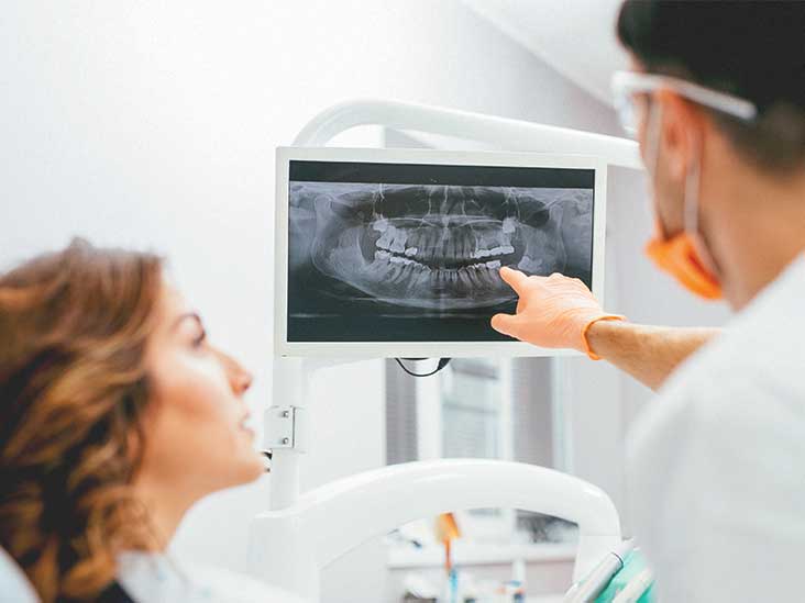 What is the Purpose of Dental X-rays?