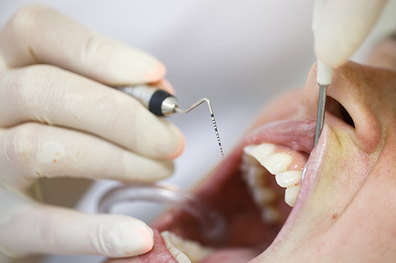 Periodontist vs. Dentist: Highlight key differences