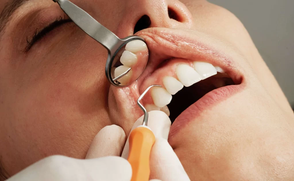Preventive Care: How a General Dentist Keeps Your Smile Bright