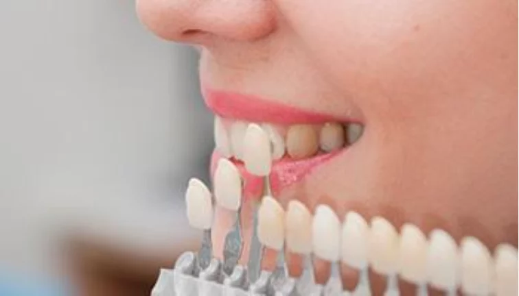 What are Important Ways to Remove Plaque and Tartar from the Retainers? 