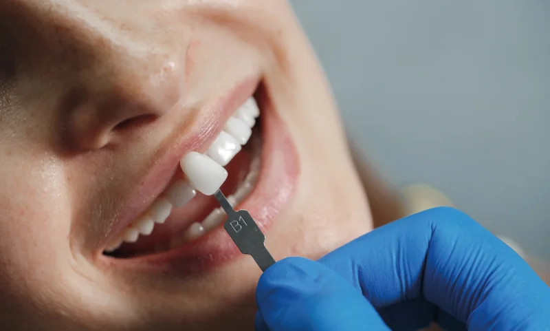 Transforming Smiles: How Family Dentists Enhance Oral Health and Aesthetics