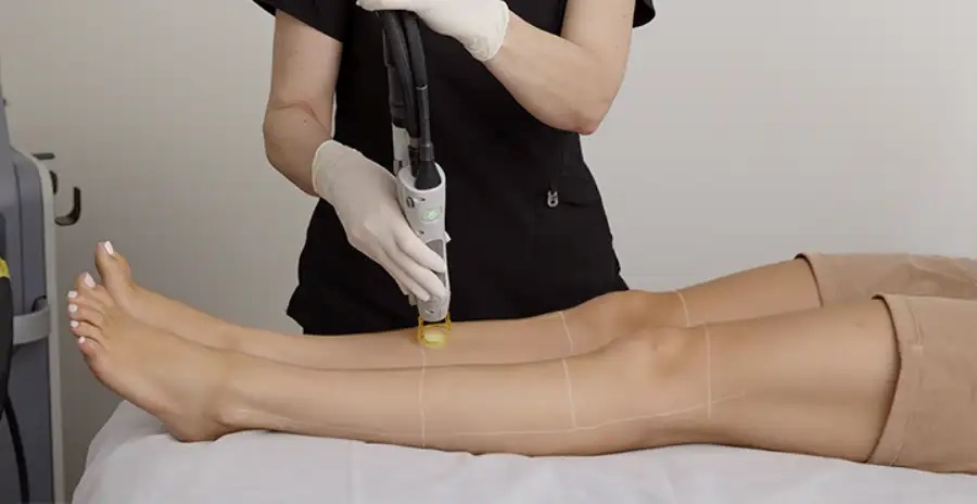 Prepping for a Big Event? How Laser Hair Removal in Goodyear, AZ, Completes Your Makeover