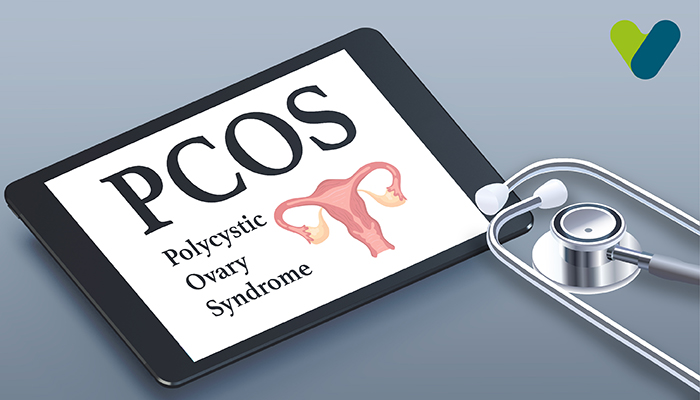 PCOS in Your 20s vs. 30s: How Symptoms and Treatment Evolve