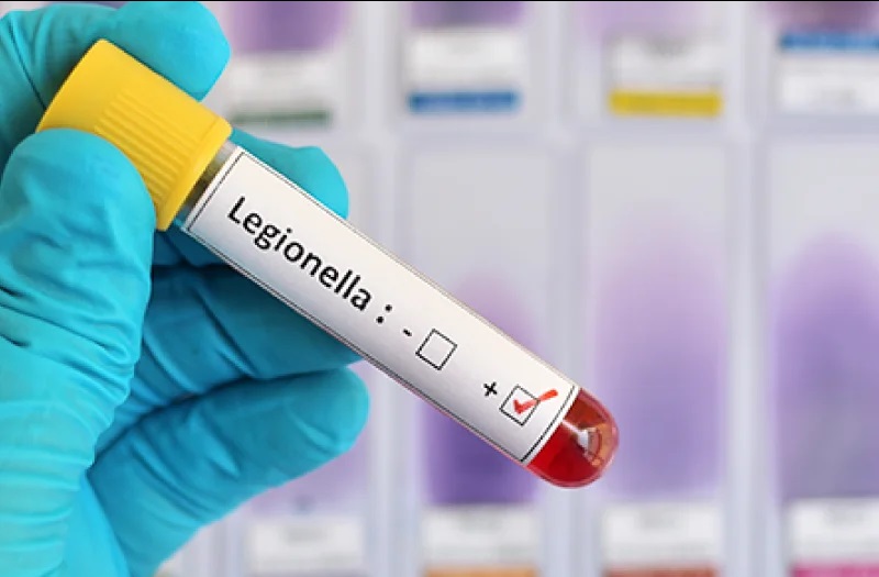 Why Every Organisation Needs Legionella Risk Assessment Experts to Stay Compliant