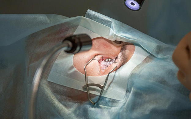 Is LASIK Right for You? Factors That Determine Candidacy and Outcomes