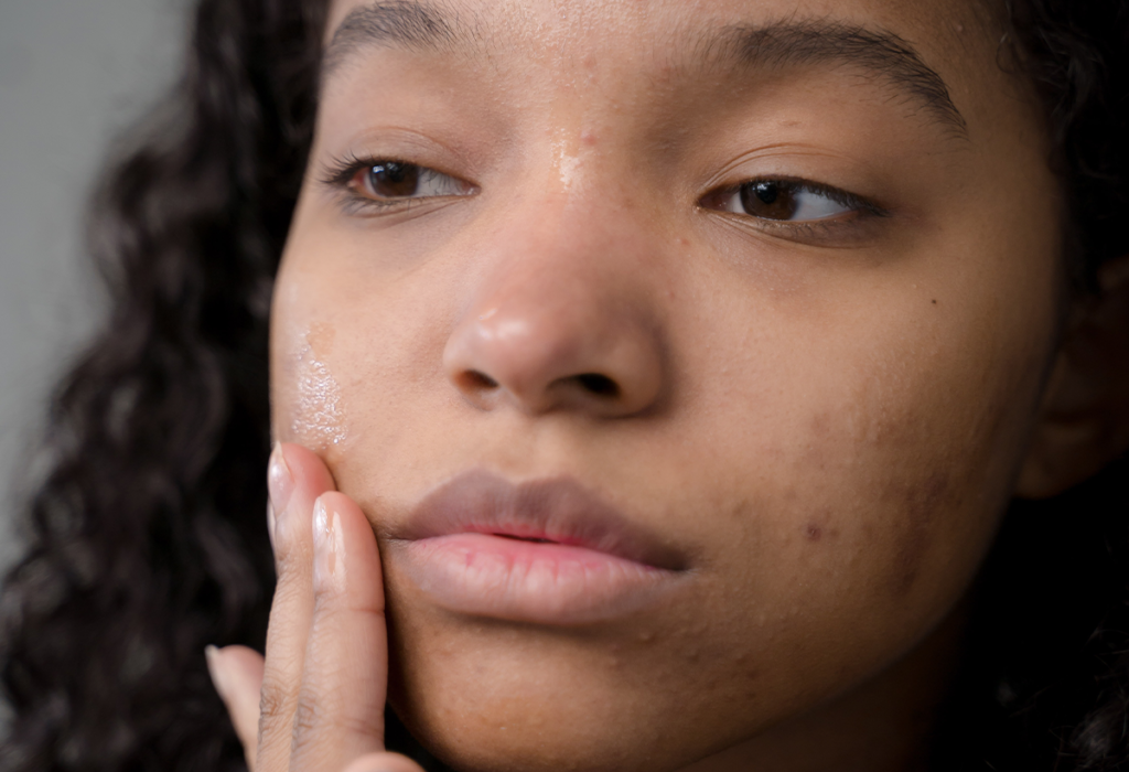 Psychological Effects of Common Skin Conditions