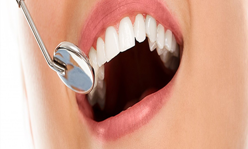 Preventive Dentistry Explained: Protecting Teeth Long Term